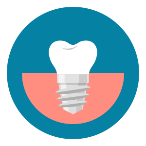 implant is the substitute for tooth root tht goes into the bone and then functions like a natural tooth once the prosthesis is placed on it.